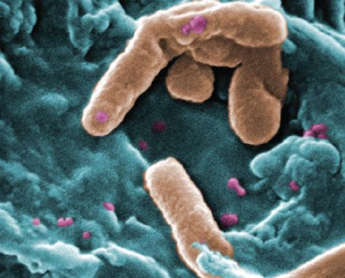 Pseudomonas aeruginosa – eine der häufig vorkommenden Bakterienarten in Kühlschmierstoffen